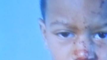 El menor tiene necesidades especiales.