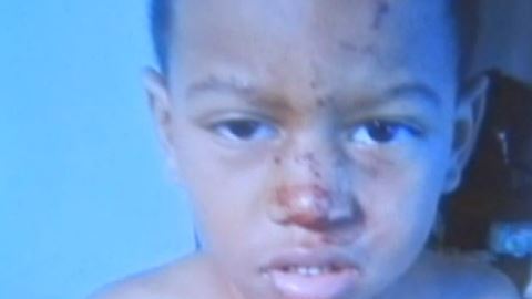 El menor tiene necesidades especiales.