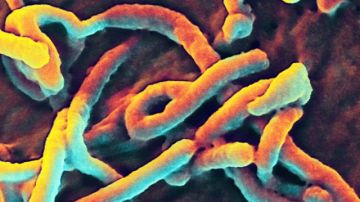 Una imagen proporcionada el 28 de agosto 2014 en el Instituto Nacional de Alergias y Enfermedades Infecciosas muestra una micrografía electrónica de barrido de virus Ebola.