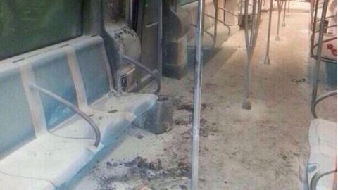 El sospechoso está hospitalizado con quemaduras en segundo grado.