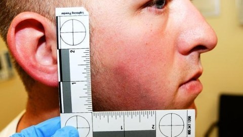 Evidencia muestra un leve moretón en la cara de Wilson.