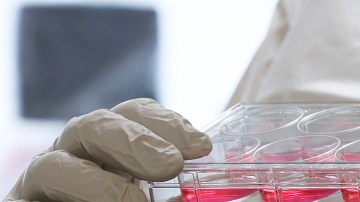 La peste bubónica puede causar la muerte en 24 horas