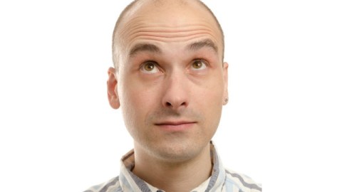 Muchos hombres comienzan a perder cabello antes de cumplir los 30 años.