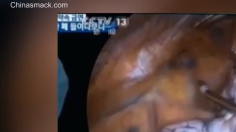 El video muestra en detalle pulmones ennegrecidos en distinto grado.