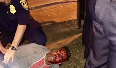 Fotos en redes muestran al estudiante con el rostro ensangrentado.