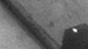 La enfermedad del legionario es una forma mortal de neumonía bacteriana.