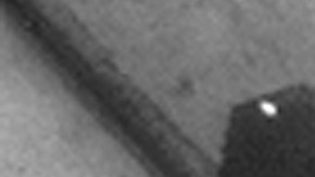 La enfermedad del legionario es una forma mortal de neumonía bacteriana.