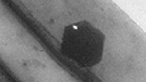 La enfermedad del legionario es una forma mortal de neumonía bacteriana.