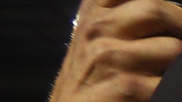 Tony Romo, quarterback estrella de los Cowboys, con su brazo izquierdo inmovilizado luego de sufrir la fractura de la clavícula izquierda.