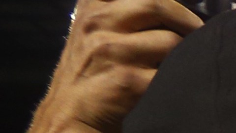 Tony Romo, quarterback estrella de los Cowboys, con su brazo izquierdo inmovilizado luego de sufrir la fractura de la clavícula izquierda.