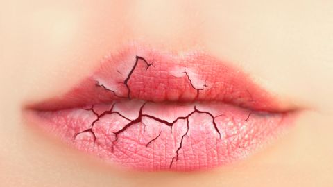 labios secos
