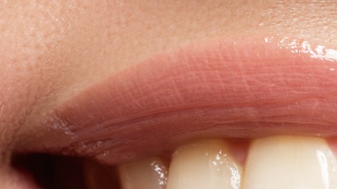 blanquear dientes