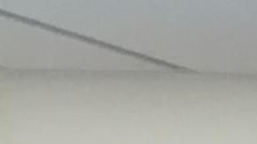 El ThermiTight es un procedimiento indoloro que por lo regular toma menos de 60 minutos en su realización.