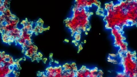 La peste bubónica es causada por una bacteria