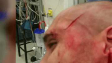 El guardia correccional atacado en Rikers Island recibió 20 puntos por las heridas que le propicionaron.