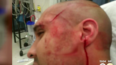 El guardia correccional atacado en Rikers Island recibió 20 puntos por las heridas que le propicionaron.