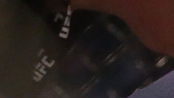 Ronda Rousey tuvo que ser hospitalizada tras el combate en el que perdió el invicto y el cinturón de peso gallo del UFC ante Holly Holm.