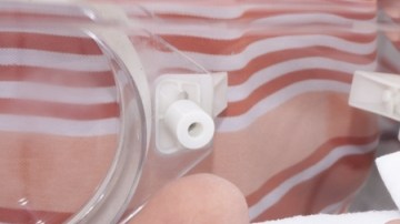 El nacimiento prematuro es aún la principal causa de mortalidad de los bebés en el país.