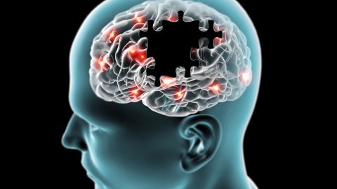 cerebro
