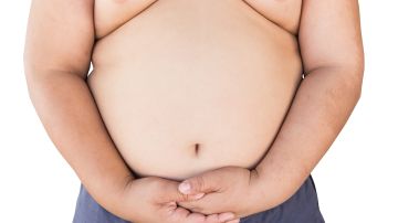 Más de un cuarto (28%) de los niños latinos de edades entre 8 y 16 años tienen obesidad.