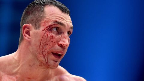 Klitschko ha entrenado muy duro para la pelea después de no competir durante dos años.