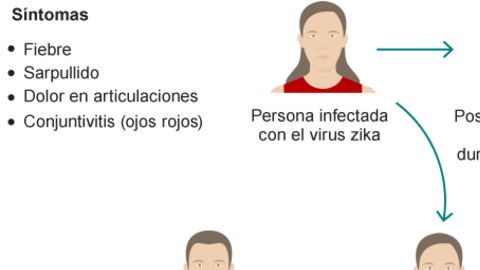 virus zika