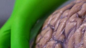 cerebro humano