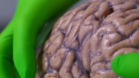 cerebro humano