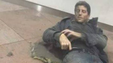 Bellin tendrá que ser sometido a varias cirugías para tratar de salvarle las piernas.
