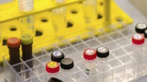 Científicos han descubierto que el virus del zika puede "vivir" en el semen hasta por 6 meses.