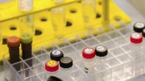 Científicos han descubierto que el virus del zika puede "vivir" en el semen hasta por 6 meses.