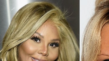 Después de tantas operaciones es difícil reconocerlas.