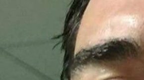 El jugador de rugby subió la imagen de su corte en la nariz en redes sociales.