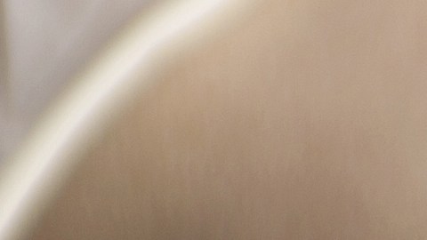 La psoriasis se presenta más que todo en codos, rodillas, cuero cabelludo, manos y pies.