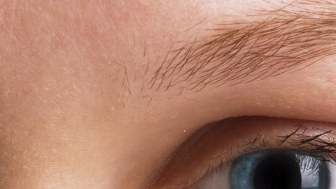 ojeras