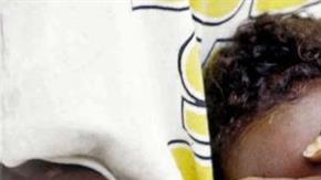 Foto de archivo de una ablación en Somalia.