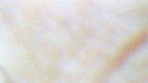 El aumento en la calidad de la droga ha hecho que muchos consumidores no solo la inyecten sino que la inhalen y mezclen en bebidas.