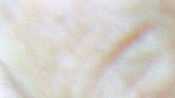 El aumento en la calidad de la droga ha hecho que muchos consumidores no solo la inyecten sino que la inhalen y mezclen en bebidas.