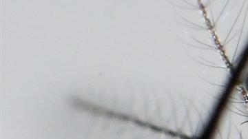 El mosquito Aedes Aegypti transmite  el virus del Zika.