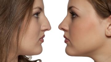 Científicos descubren cinco genes específicos que influyen sobre el tamaño y la forma de los rasgos de la nariz y el mentón de la gente nacida en ciertos países de Latinoamérica.