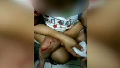 Las ratas atacaron al menor mientras dormía.