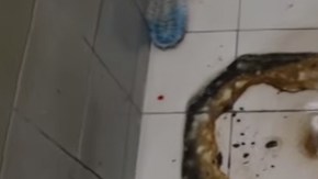 La serpiente le mordió el miembro a la víctima.