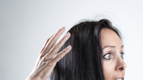 caida cabello