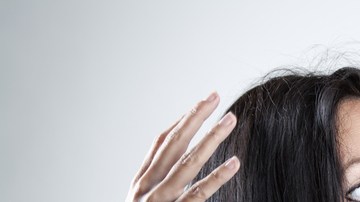 caida cabello