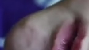 Un  bebé estadounidense nació con una malformación producto de una enfermedad congénita que hizo que su cerebro se desarrollara fuera de la cabeza.