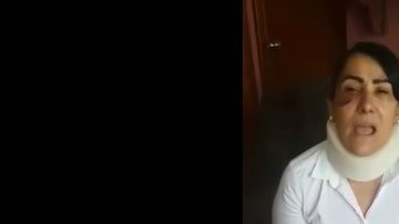 La mujer viajaba en un autobús.