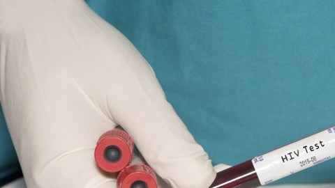 El CDC recomienda que todas las personas entre los 13 a 64 años se hagan la prueba del VIH una vez al año.