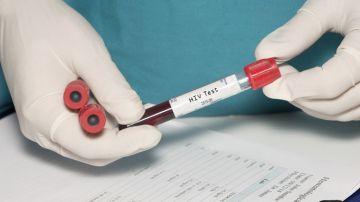 El CDC recomienda que todas las personas entre los 13 a 64 años se hagan la prueba del VIH una vez al año.
