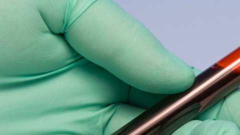 El RH Nulo fue descubierto en la década de los 60.