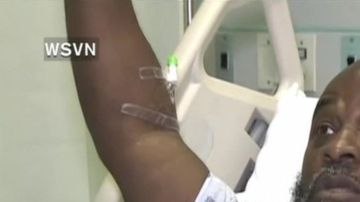 Charles Kinsey estaba desarmado cuando recibió un disparo de la policía en Miami.